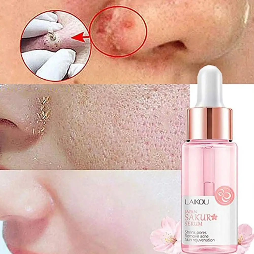 

Blossom Essence Makeup Base Whiten Skin Careing Primer Makeup Erin Face Moisturizer Essence Anti Care T3w7