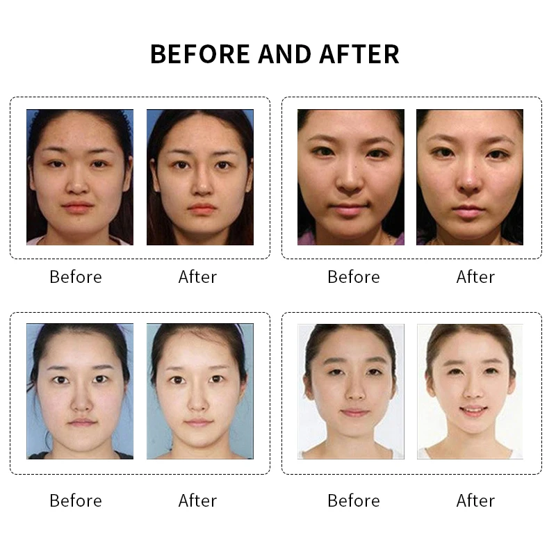 Маска лифтинг для лица V образная маска похудения подтяжки подбородка кожи