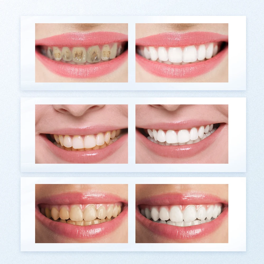 BAIMISS отбеливание зубов Φ белый крем удаление пятен бикарбонат натрия