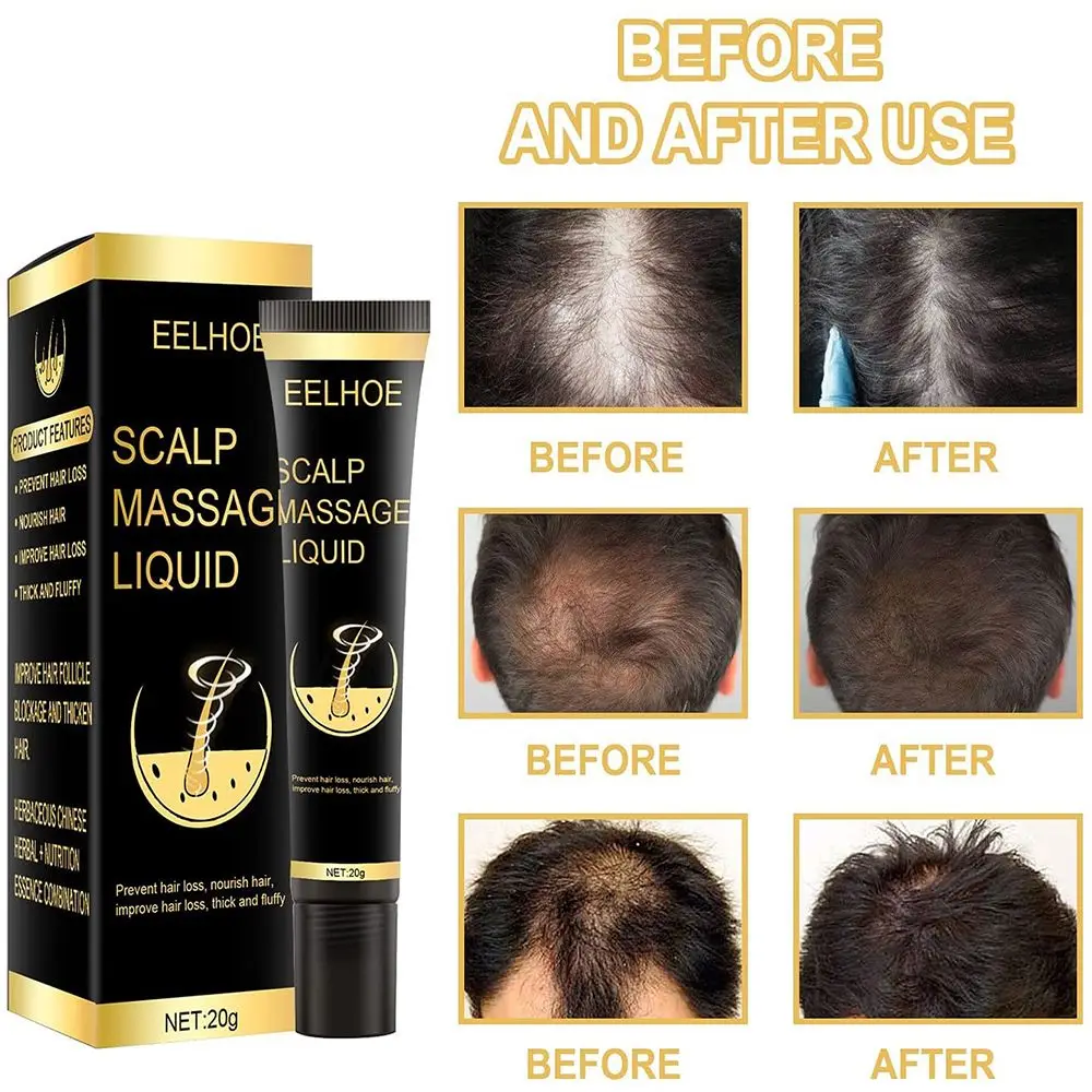 

Сыворотка для роста волос, усовершенствованная местная формула, массажная жидкость для кожи головы с массажным шариком, жидкость для волос ...