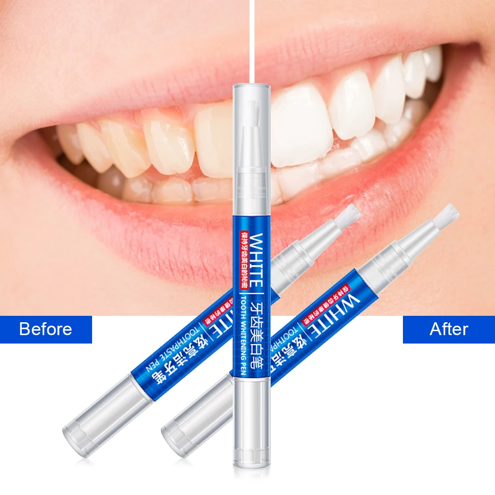 Стоматологический инструмент для чистки полости рта и зубов | Красота здоровье