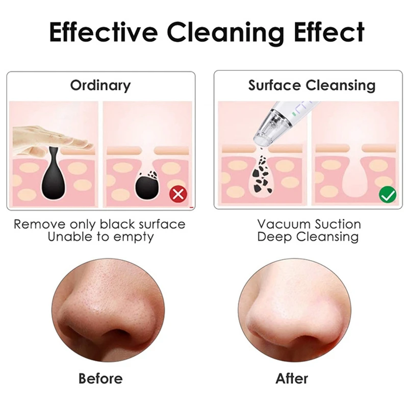 

Electric Blackhead Remover Pore Vacuum Cleaner Acne Pimple Extractor USB Rechargeable Removal Tool