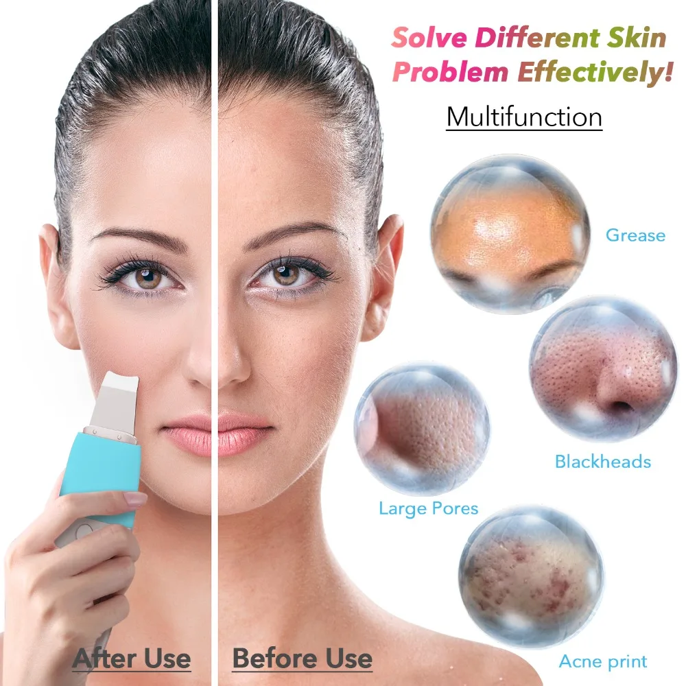 HailiCare Facial Skin Scrubber Blackhead Remover Ultrasonic Pore Cleansing Device Comedone Extractor Facial Lifting Tool