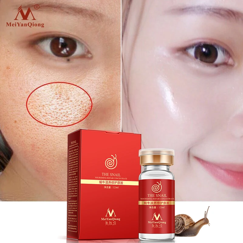 Отбеливающая увлажняющая сыворотка для лица с гиалуроновой кислотой | Красота и