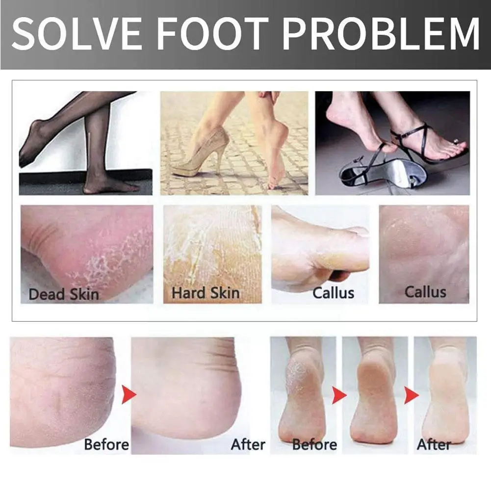 

Colossal Foot Scrubber Callus Remover Steel Foot Care File Callus Heel Rasp Skin Hard Dead Tools Pedicure Grater E3K6