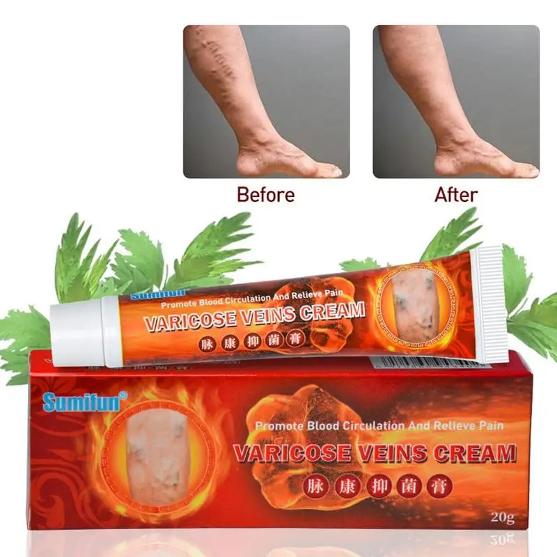 Варикозное расширение вен лечение крем мазь васкулит флебит ангиит воспаление