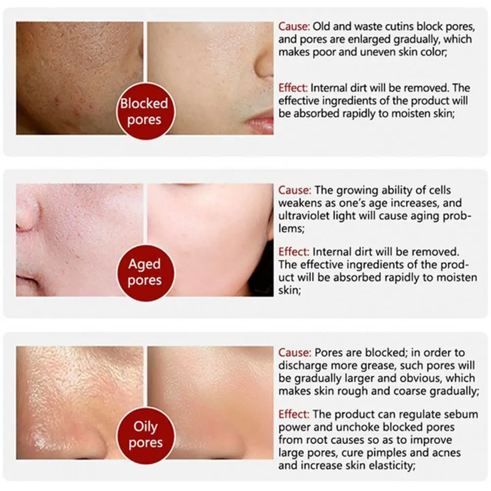 

30ml Lifting Firming Fading Fine Lines Rejuvenation Natural Brightening Emulsion Essence Skin Whitening Essence C9U9