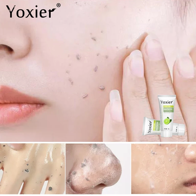 Yoxier 3 шт. очищающий Аква пилинг отбеливающий гель увлажняющий уход за кожей