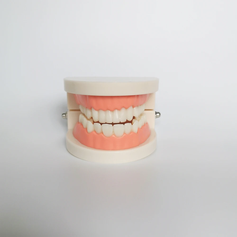 Зубная модель зубной имплантат с реставрационным мостом стоматолог медицинская