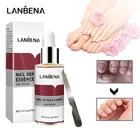 Жидкость для восстановления ногтей LANBENA, 15 мл, сыворотка для удаления онихомикоза, жидкость для восстановления ногтей от грибка, инструмент для лечения Ногтей TSLM1