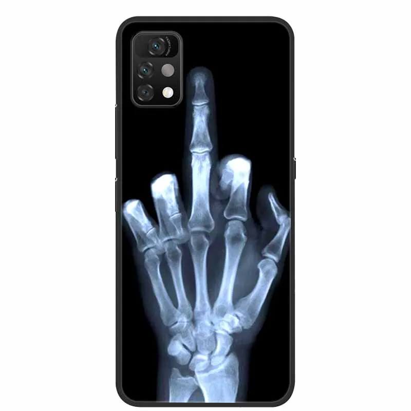 for umidigi a11 pro max case umidigi a11 a7s cartoon soft tpu silicone phone case for umidigi a11 pro max fundas umidigi a7s free global shipping