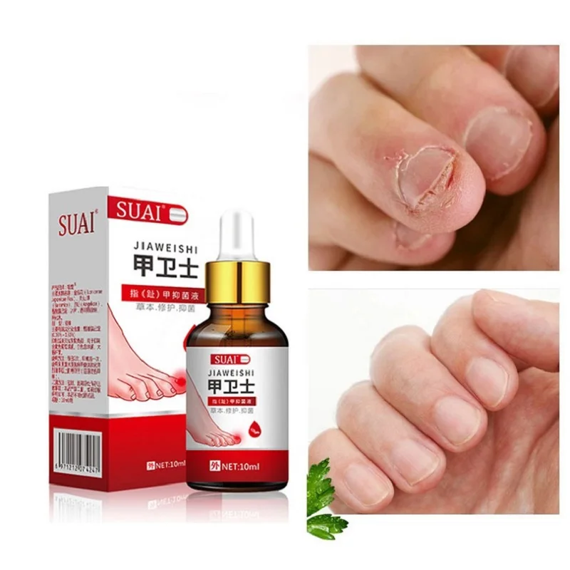 

Anti Infection Paronychia Anti Fungal Nail Treatment Essential Oil Toe Nails Fungus Repair Serum Onychomycosis Remover Foot Care