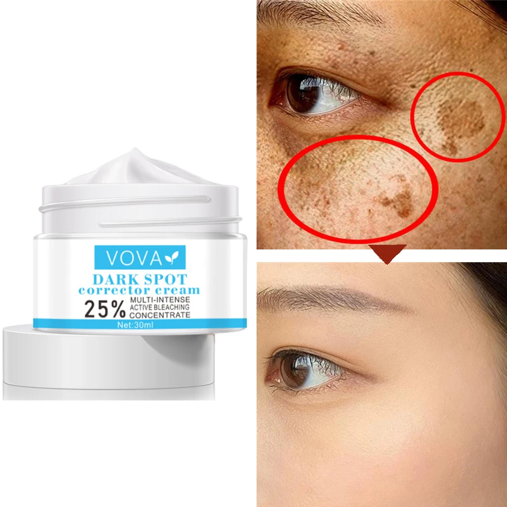 Темное пятно корректирующий крем 25% мульти интенсивный активный отбеливающий