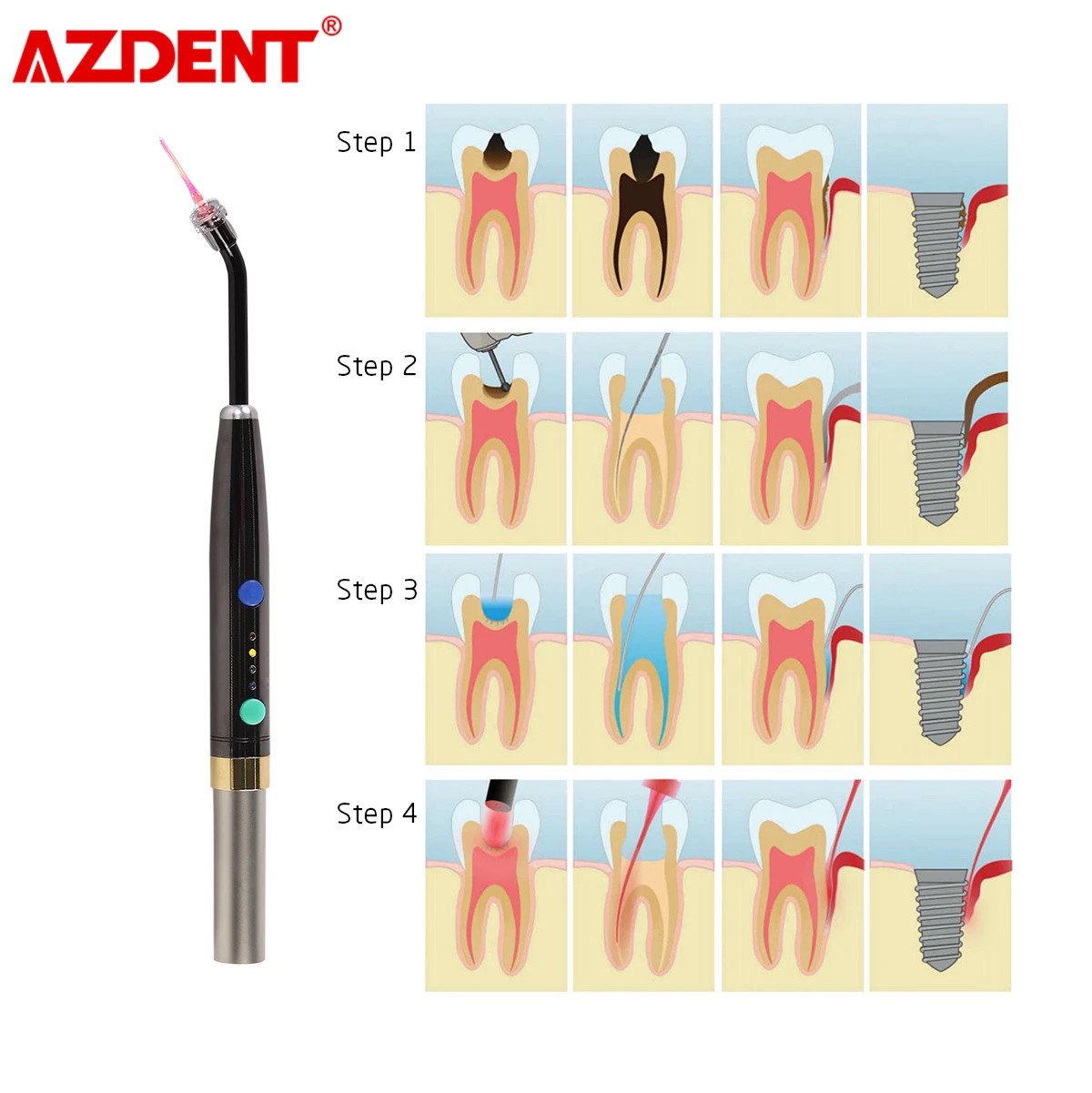 Стоматологическое фотоактивационное дезинфекционное медицинское лазерное