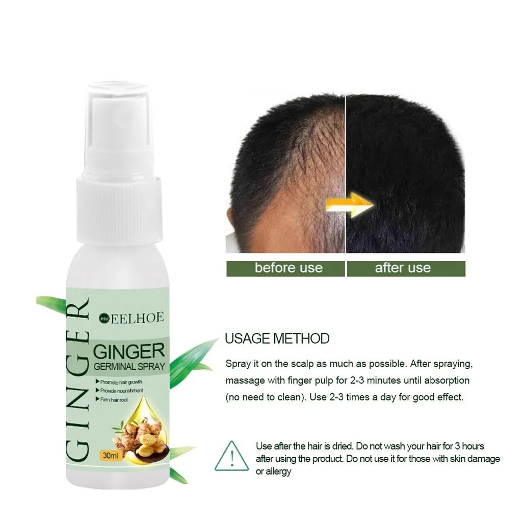 30 мл спрей для роста волос экстракт предотвращает выпадение растущие волосы