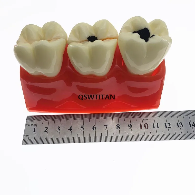 1 шт. съемные зубы для зубов размер 4:1|Стоматологическая учебная модель| |