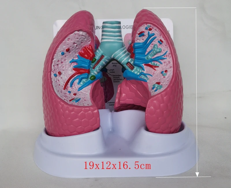 

Human pathological lung anatomy surgery biology