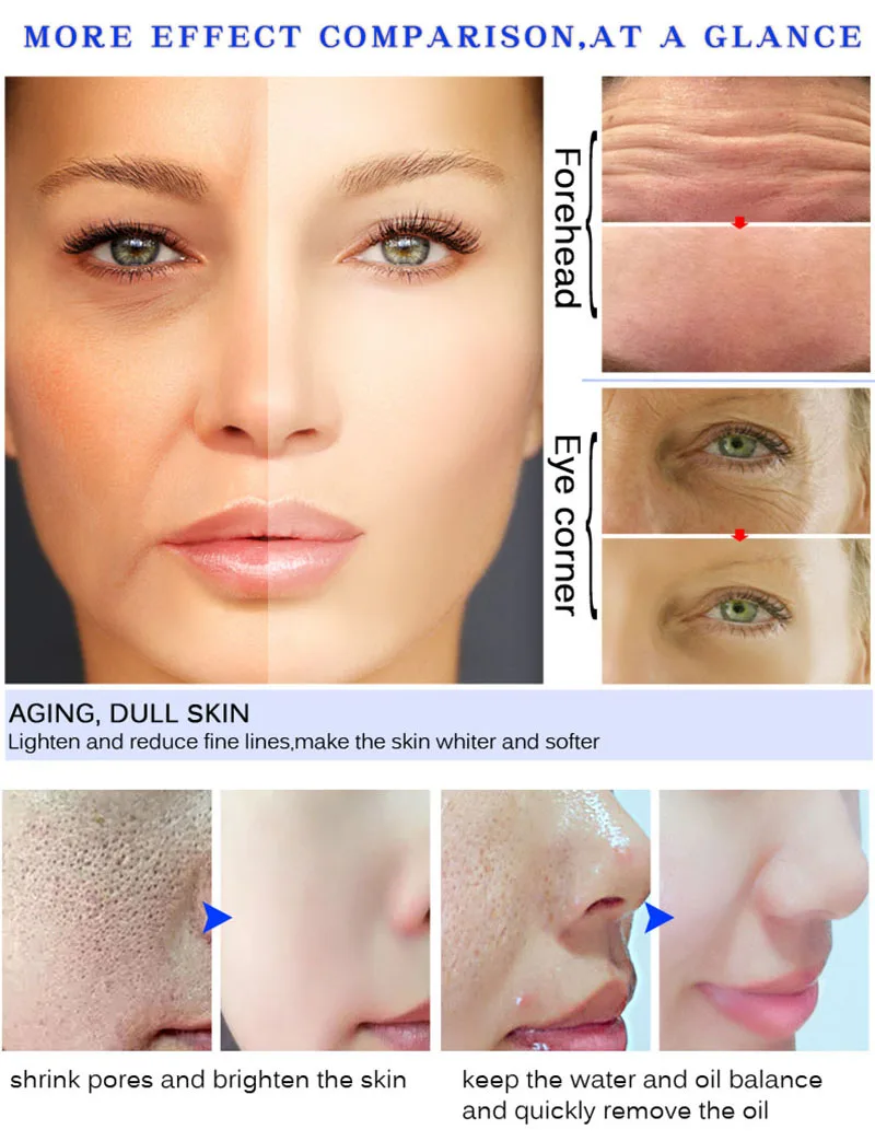 15 мл с экстрактом улитки гиалуроновая кислота эссенция увлажняющий отбеливающий