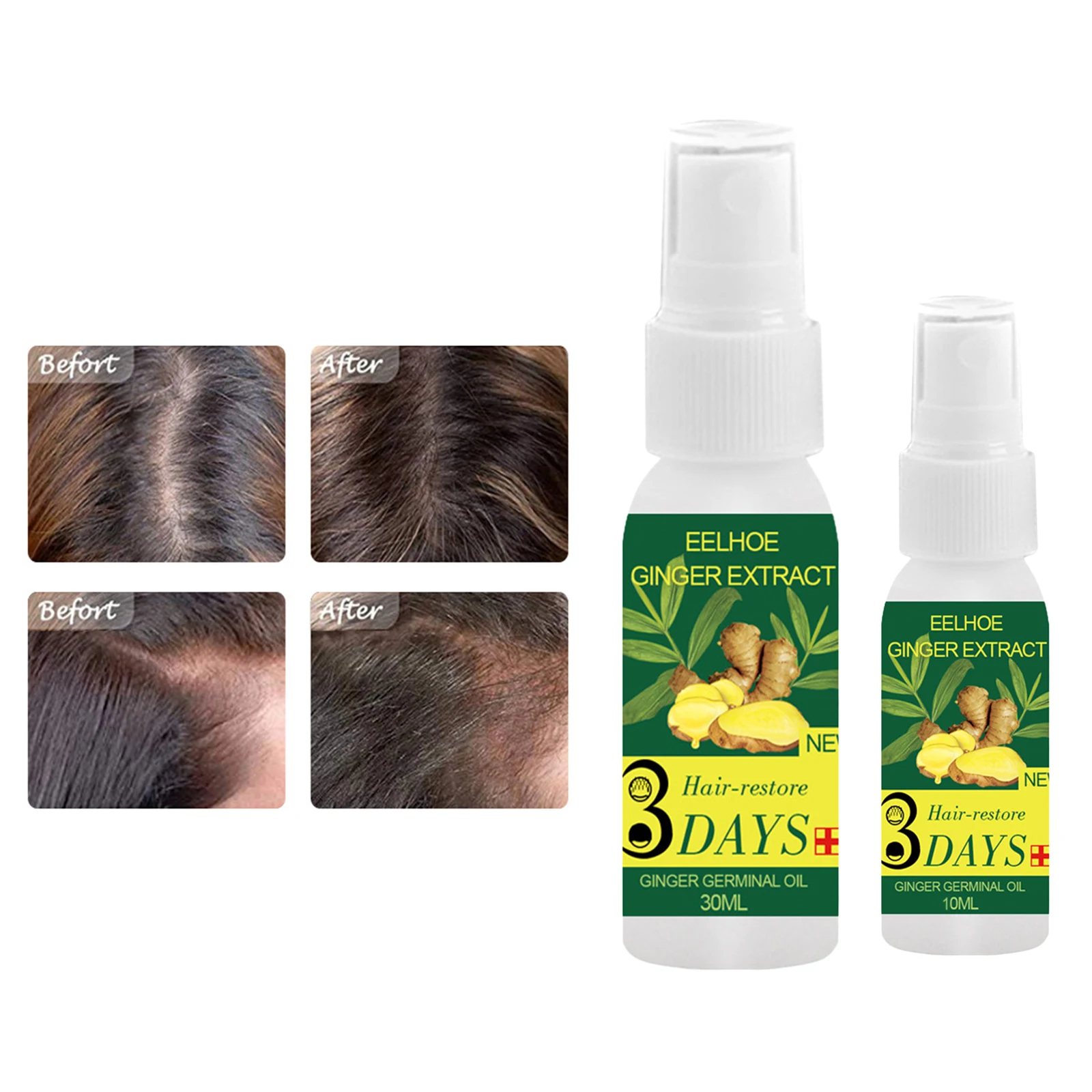 

Lymphatic Drainage Ginger Hair Growth Essential Oil Hair Care Serum Natural