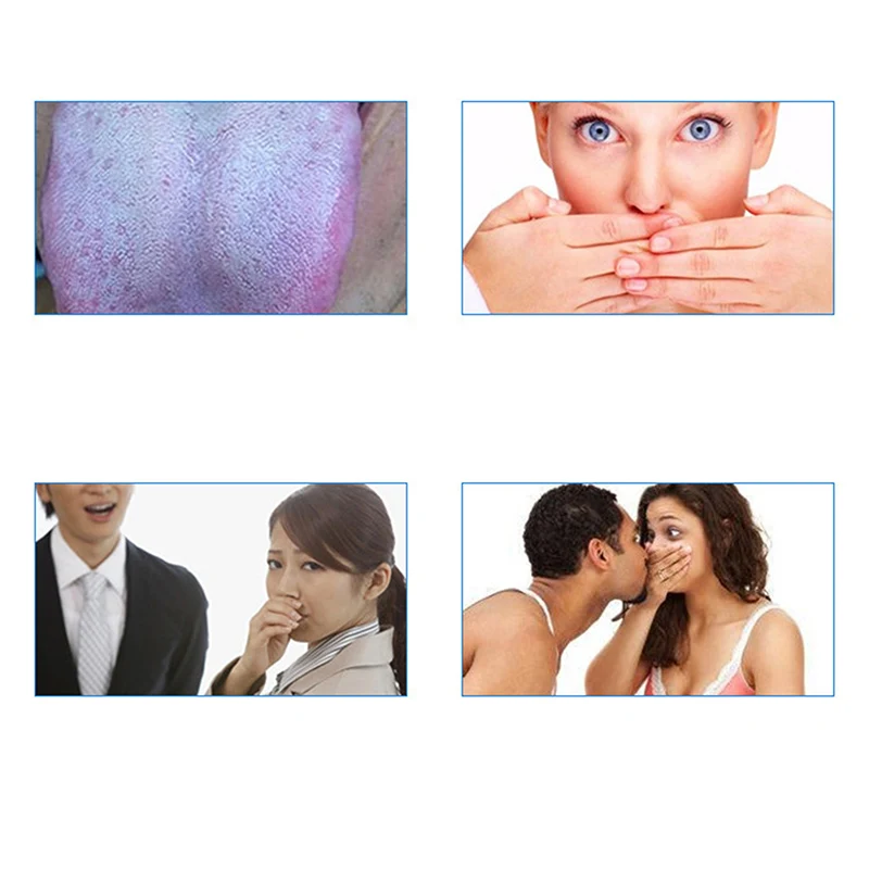 

1set Stainless Steel Tongue Cleaner Scraper for Oral Hygiene Care Fresh Breath