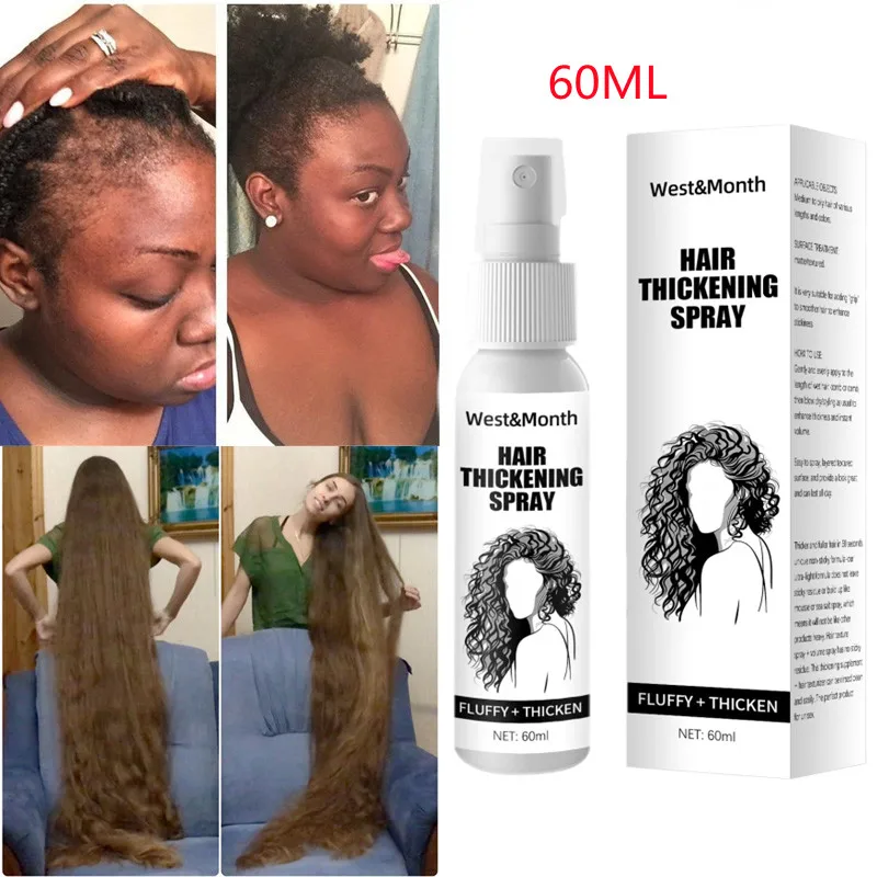 

60ml Professional Ginger Anti Hair Loss Hair Growth Spray Essential Oil Liquid Care Hair Loss Products ReGrowth Ginger Spray