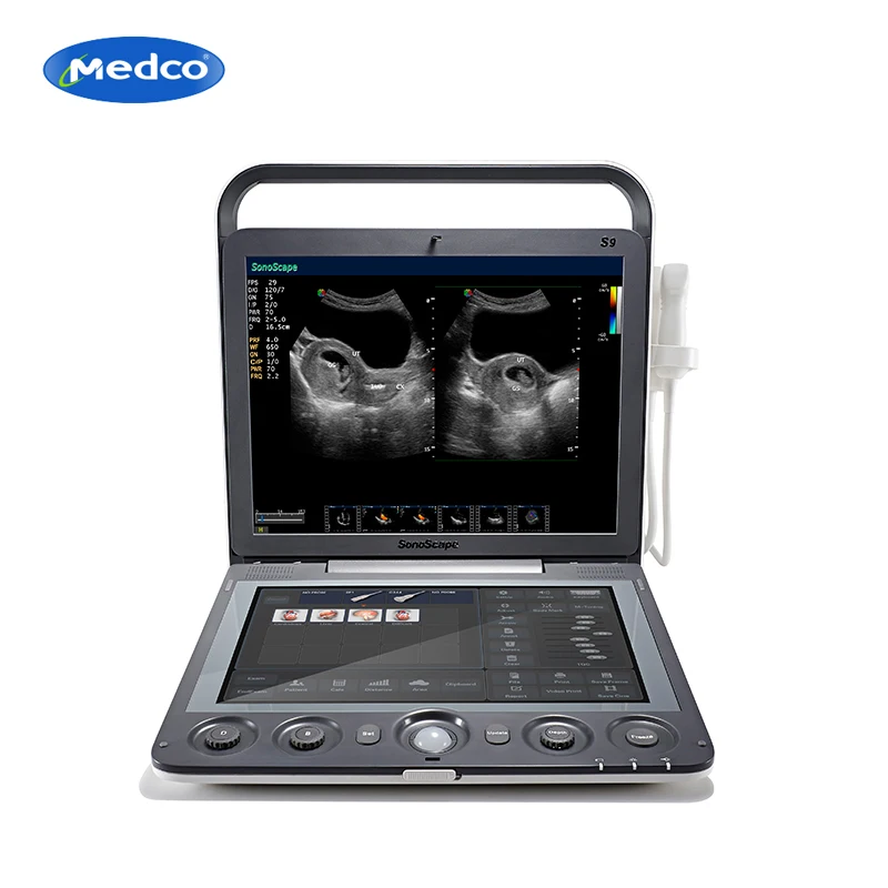 

Sonoscape S9 Portable Color ultrasound scanner with touch screen