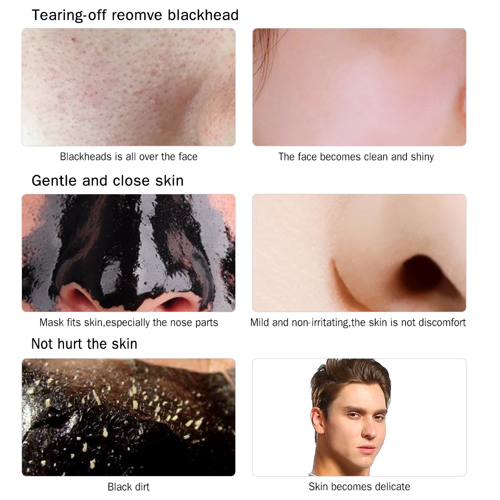 Мужская всасывающая черная маска для лица Acne Treat men ts осветляющая Очищающая Удаление угрей глубокое очищение для акне уход за шрамами на коже