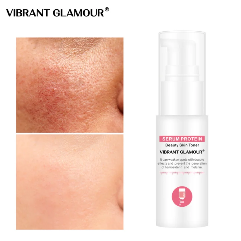 Новейшая модель Сыворотки белка уход за кожей лица Тонер для отбеливания