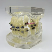 hot sale orthodontic dental treatment malocclusion model w brackets chain wire 3005 3 dental laboratory dental teeth models