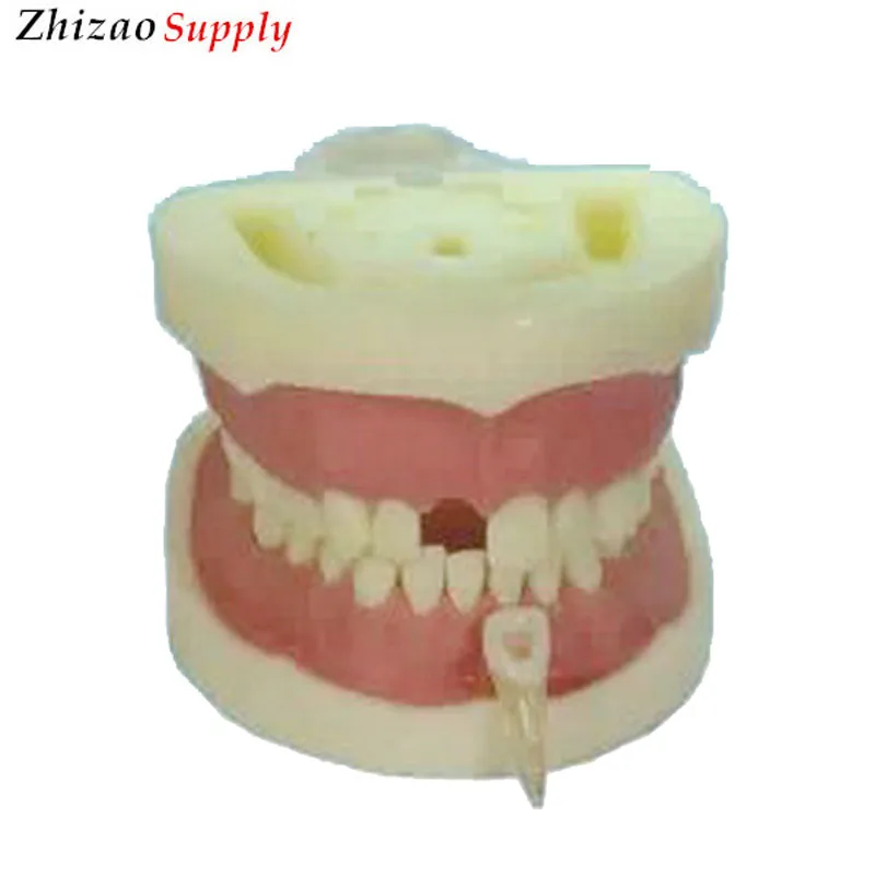 

Students practise teeth root canal model Teeth root canal model