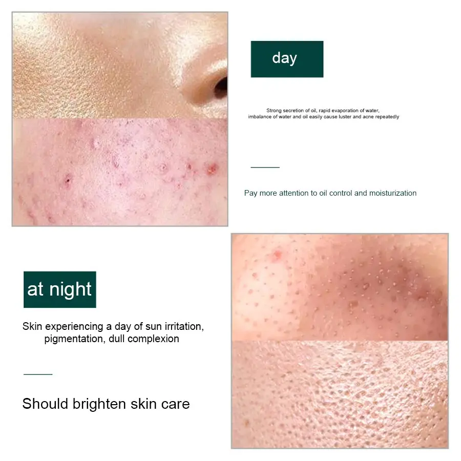 Глубоководная грязевая аминокислота LAIKOU очищающее средство для лица