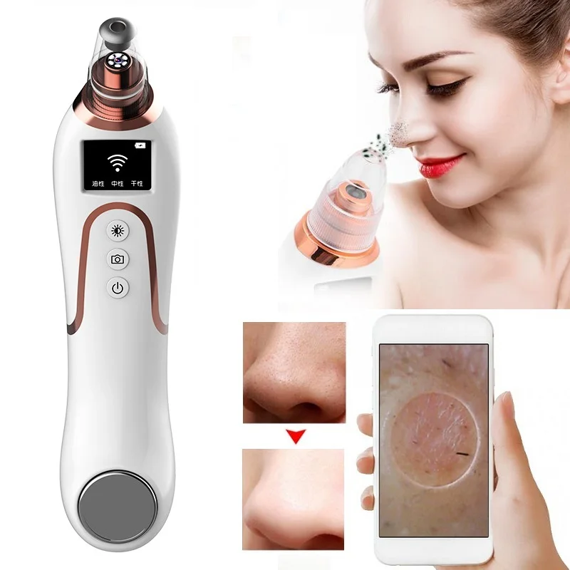 Новое прибытие умный WIFI визуальный Удаление угрей вакуумный очиститель пор