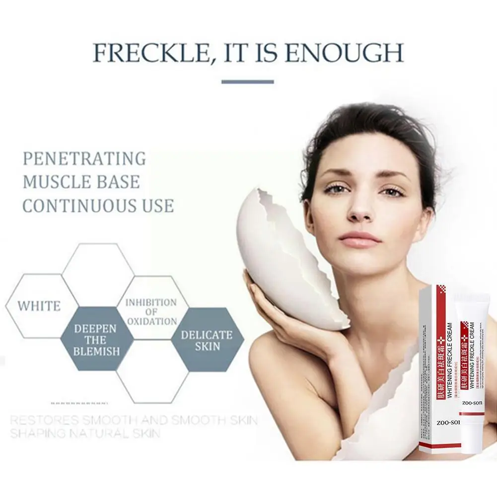 

Whitening Freckle Cream Remove Dark Spots Anti Freckle Brighten Care Melasma Skin Fade Creams Cream Pigmentation N3F8