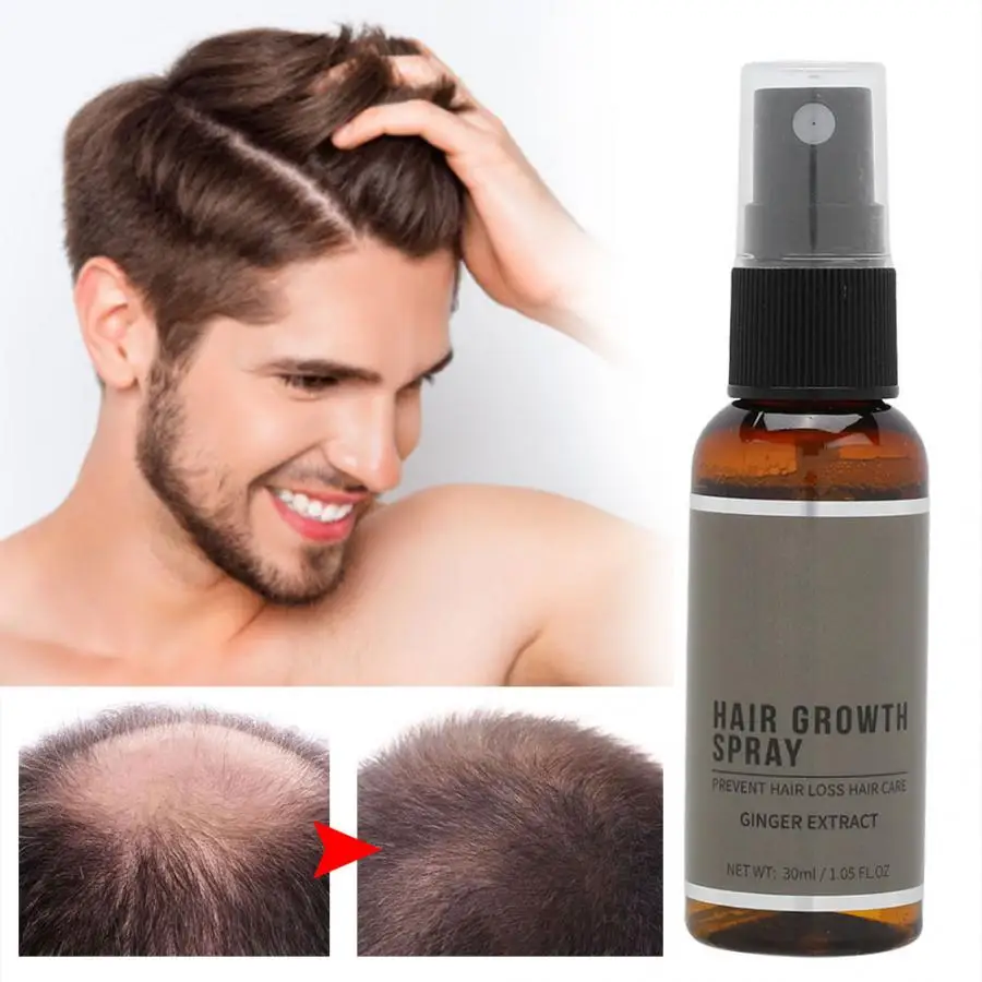 30 мл травяной экстракт спрей для роста волос лечение против выпадения жидкий