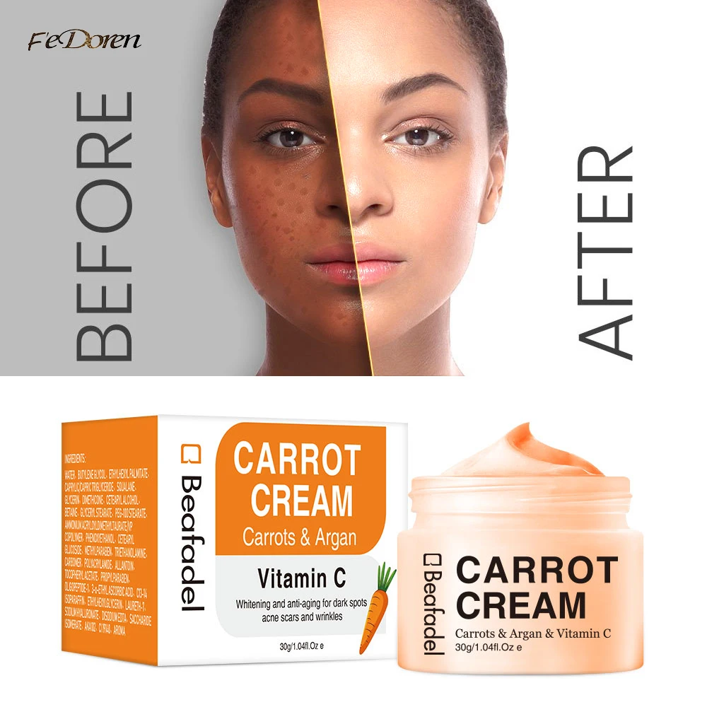 

Carrot Vitamin C Bleaching Moisturizing Facial Cream Anti Acne Wrinkle Improve Brighten Blemish Freckle Remover Korean Skin Care