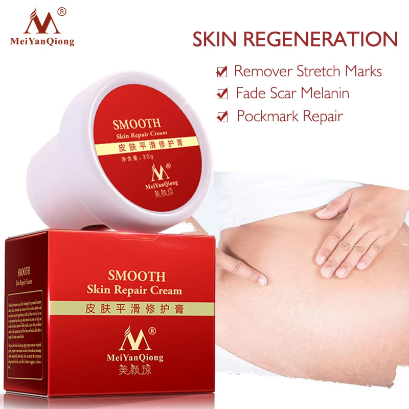 

High Quality Smooth Skin Cream For Stretch Marks Scar Removal To Maternity Skin Repair Body Cream Remove Scar Care Postpartum
