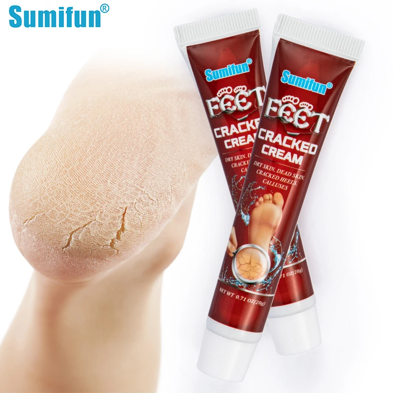 Feet Hand Anti Dry Peeling Callus Dead Skin Removal Medical Ointment Moisturizing Beauty Health