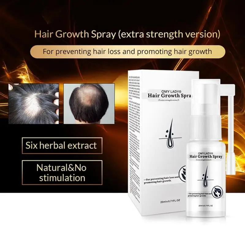 

OMY LADY Ginger Anti Hair Loss Hair Growth Spray Dropshipping F6F1