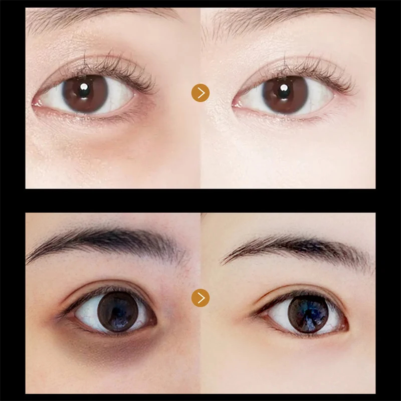 Патчи коллагеновые золотые Антивозрастные для кожи вокруг глаз от Тёмных кругов