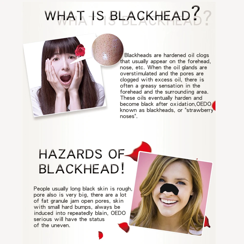 Розовая маска для удаления угрей Крем Т образный уход чистая кожа усадочная поры