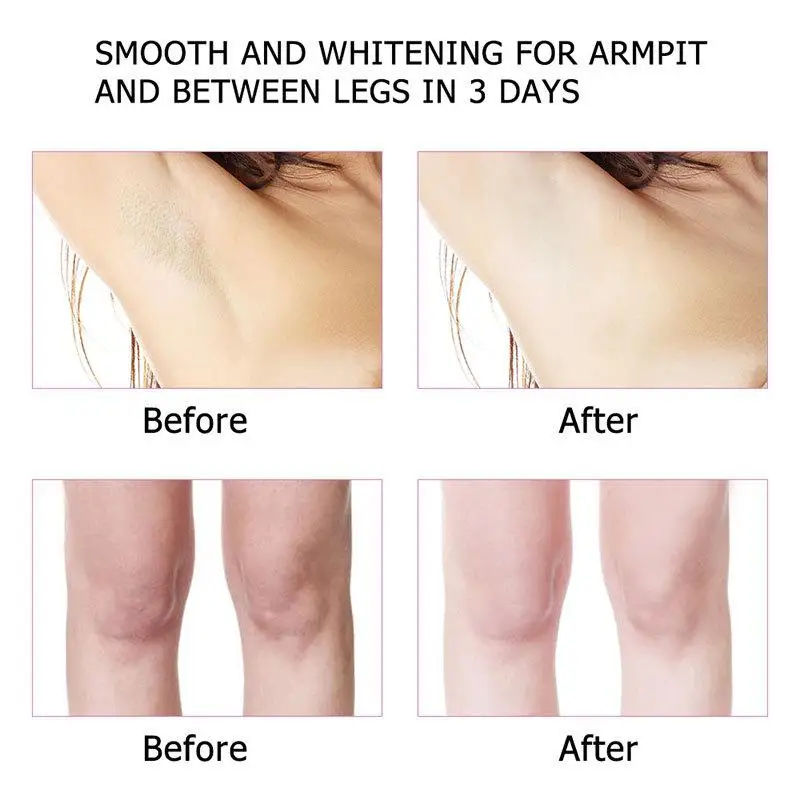 

50g Underarm Whitening Cream Brightening Armpit Whitening Bleaching Cream Beauty Body Lotion Moisturizing Cosmetics Skin Care