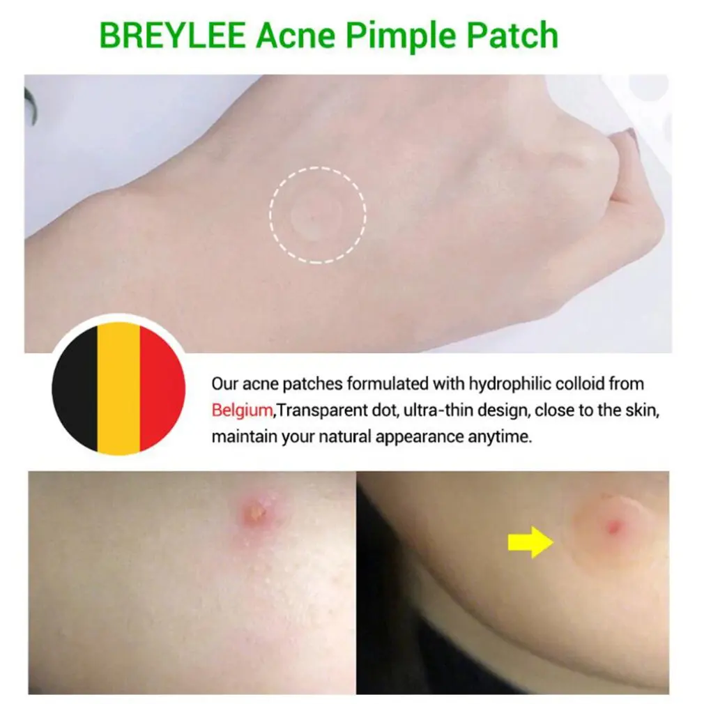 Набор наклеек для лица чайное дерево акне ремонт анти-акне увлажняющий раствор