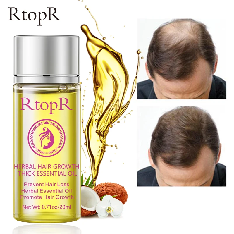 Травяное масло для роста волос RtopR густое эфирное предотвращает выпадение