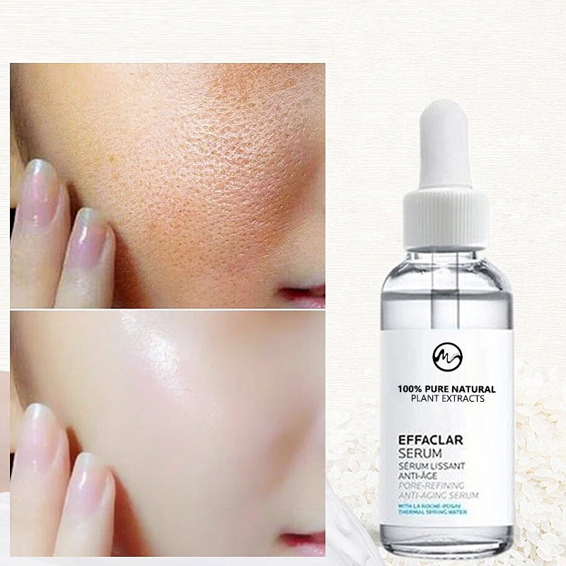 Minch анти морщинки эссенция для лица масла Pore обработки Сыворотки угорь средство