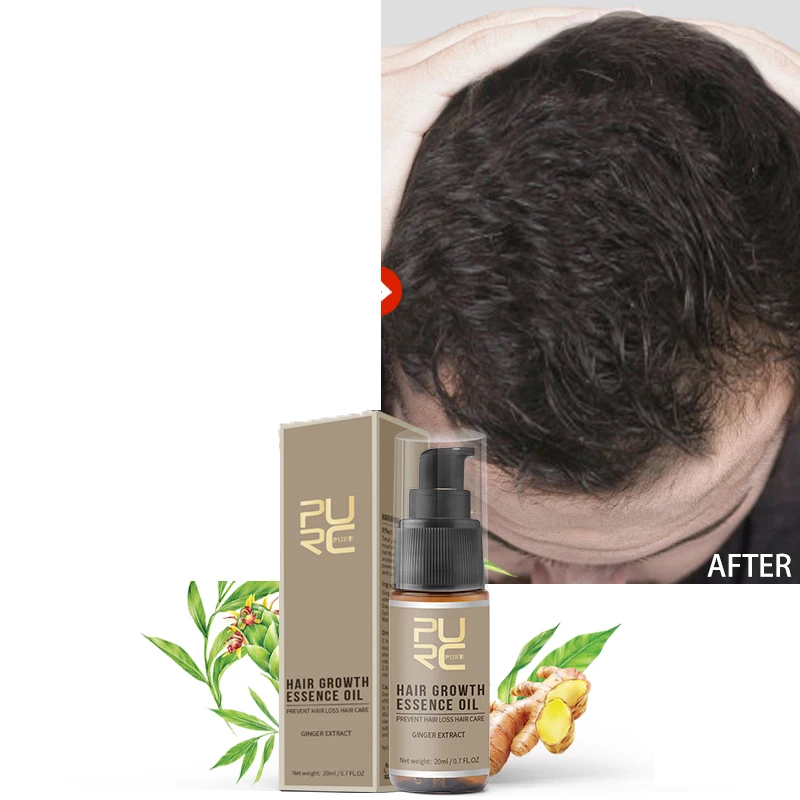 

Горячая Распродажа масло для лечения выпадения волос, средство для роста волос, уход за волосами 20 мл