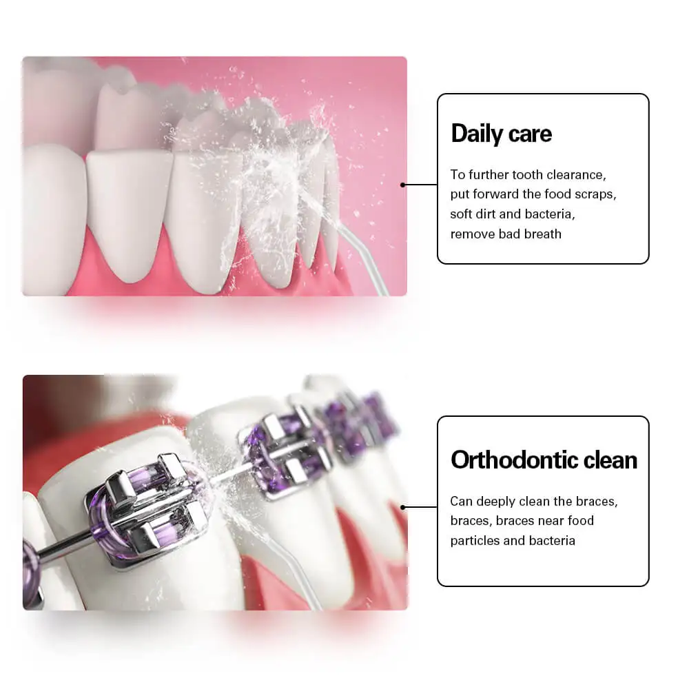 Ирригатор полости рта AZDENT портативный ирригатор 5 насадок для чистки зубов