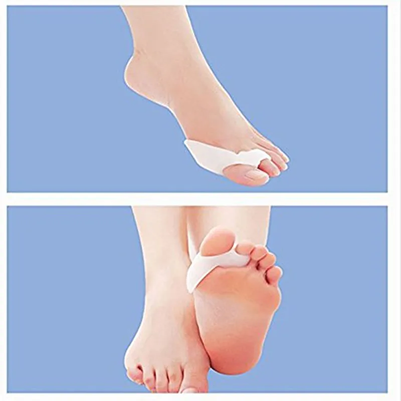 Оригинальные специальные bicyclic ортопедические Брекеты для коррекции