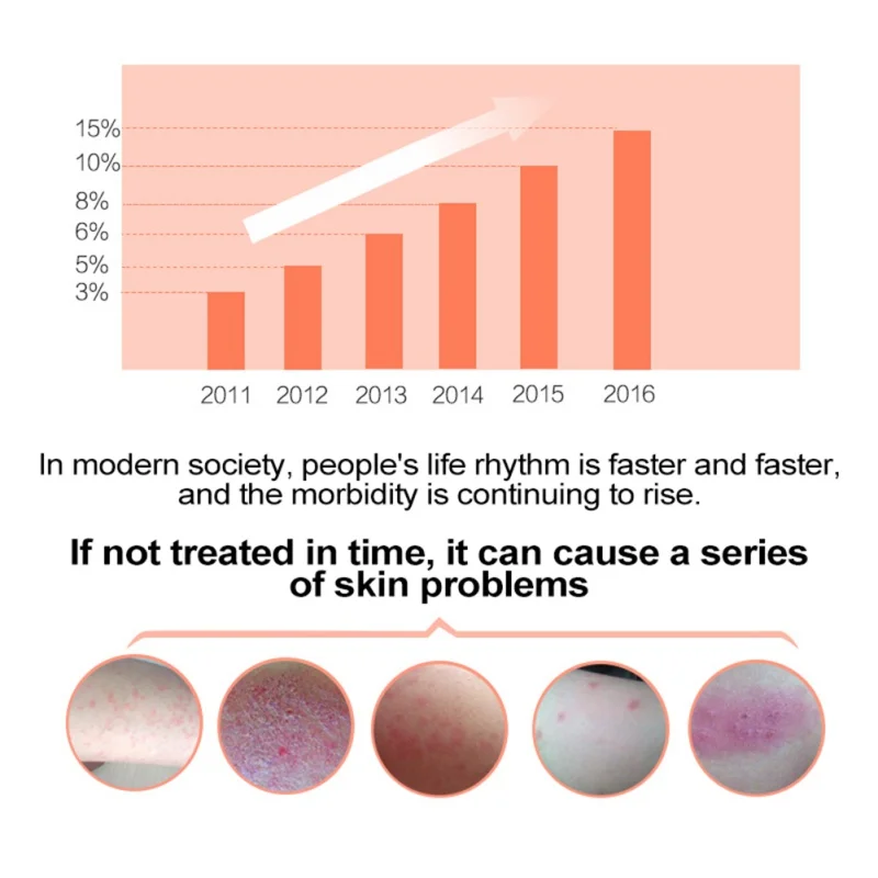 Полезно оригинальный псориаз дерматит экзема зуд проблемы с кожей крем для