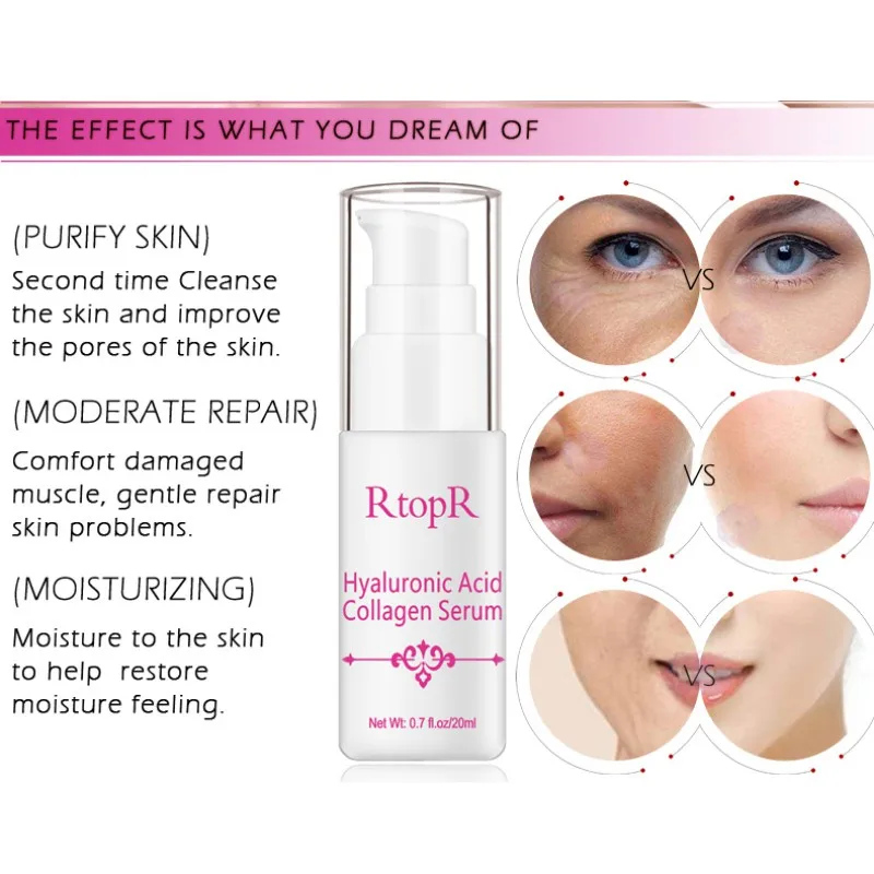 20ml Pregnant Woman Hyaluronic Acid Collagen Face Serum Anti Wrinkle Acne Treatment Essence Whitening Anti-Aging Facial |