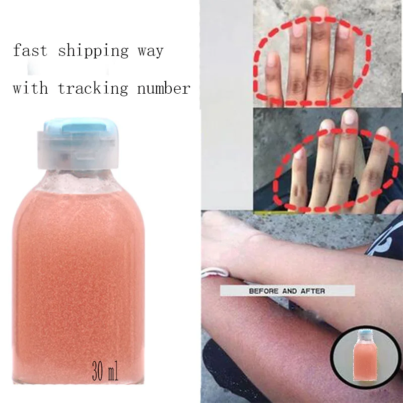 

Сильные руки и ноги отбеливающий Осветляющий очищающий Сыворотки, чтобы очистить темно-кастет плавления и Осветление кожи 30 мл